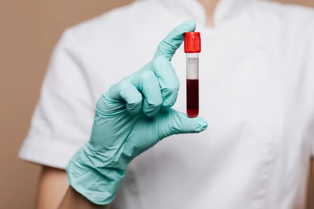 ESTUDO COM IA E EXAME DE SANGUE PODE MUDAR DIAGNÓSTICO DA HANSENÍASE NO BRASIL
