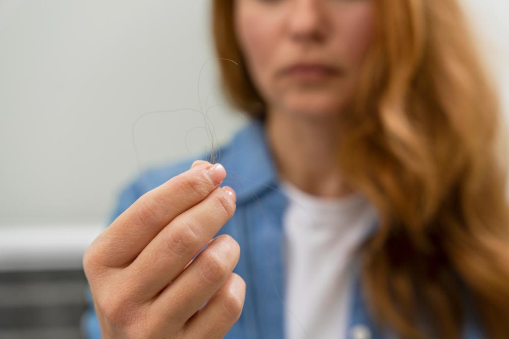 QUEDA DE CABELO PODE SER SINAL DE ALTERAÇÕES NO ORGANISMO